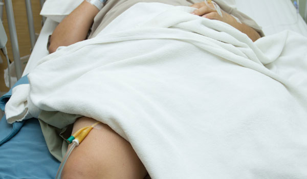 Urinary-Catheter-imgjpg