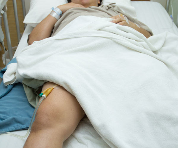 Urinary-Catheter-imgjpg